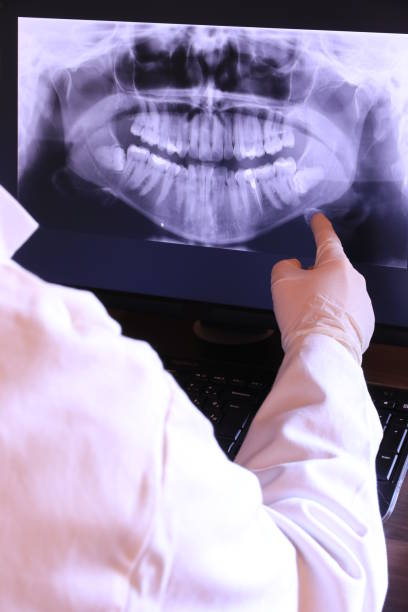 Best Emergency Dentist for Lost Fillings or Crowns in Waelder, TX
