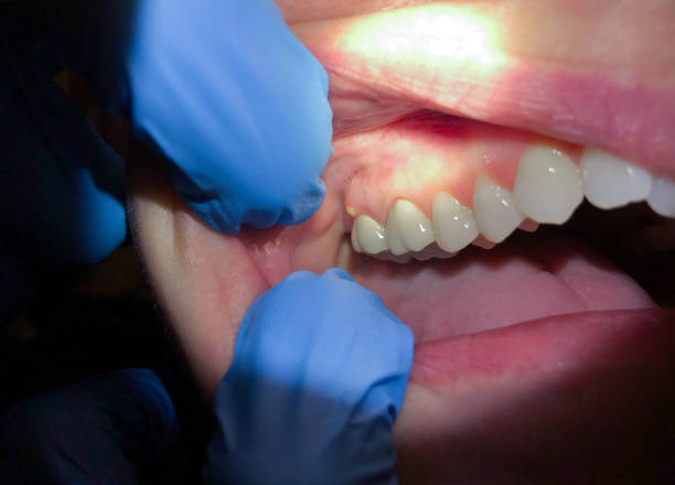 Best Broken or Cracked Tooth Emergency Dentist in Waelder, TX